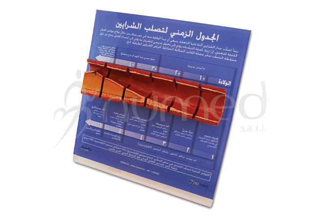Atherosclerosis Timeline Display (Arabic)