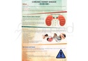 [ERP001ES] Chronic Kidney Disease, Overview Poster (English)