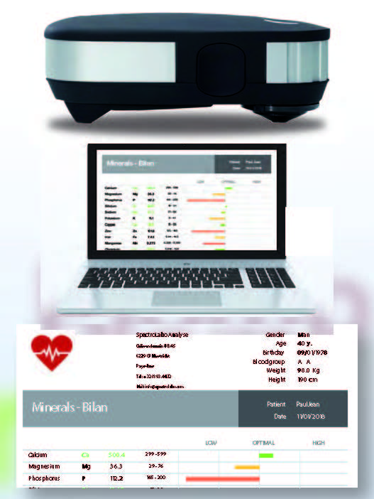 Spectrolabo, pack of 60 tests