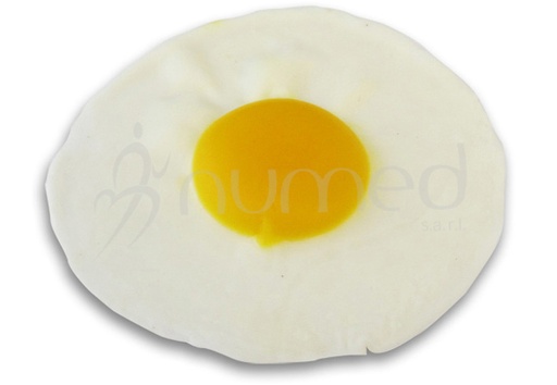 [ENFMMEA4] Egg, fried